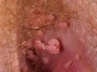 Utilizarea de măști faciale Utilizarea de măști faciale