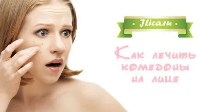 Ce este comedoane pe fata Ce este comedoane pe fata