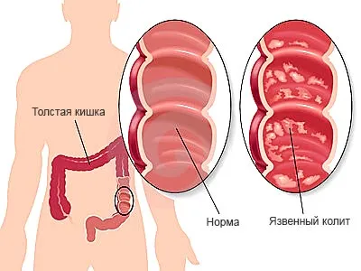 Gastroenterologi trata ca Gastroenterologi trata ca