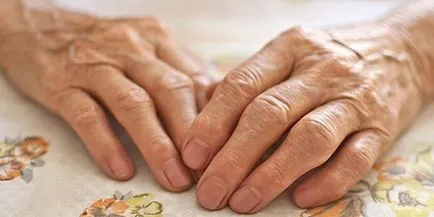 tratamentul polyosteoarthrosis tratamentul polyosteoarthrosis