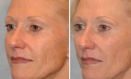Care sunt micro-curenți în cosmetologie