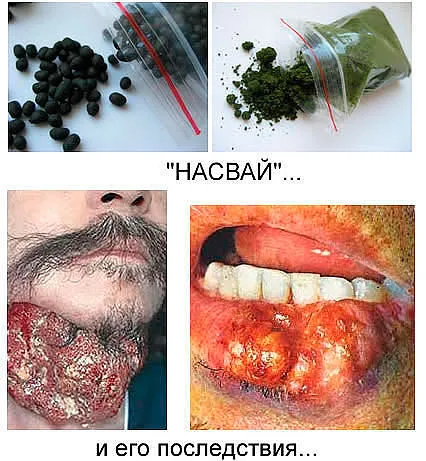 Natsvay ce este