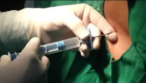 tratamentul polyosteoarthrosis