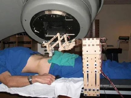 pregătire de prostată Uzi