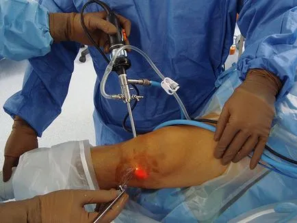 tratamentul polyosteoarthrosis