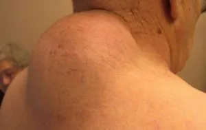 Perlele pe gâtul lui de la ceea ce Perlele pe gâtul lui de la ceea ce