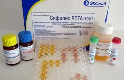 Ce este un RPR