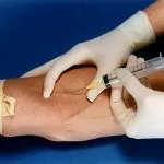 peptidele Hormonul