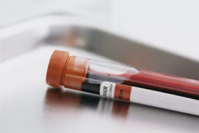 peptidele Hormonul