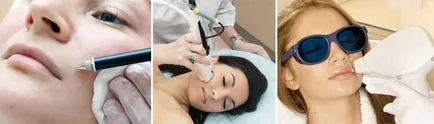 Cum de a elimina parul nedorit facial Cum de a elimina parul nedorit facial