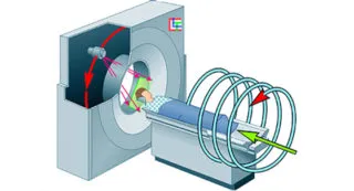 Multislice tomografie computerizata este