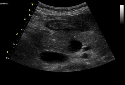 Uzi preparare pancreas