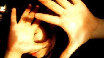 Alergia la tratamentul de semne de soare remedii populare - 30 rețete! (Sun) Alergia la tratamentul de semne de soare remedii populare - 30 rețete!