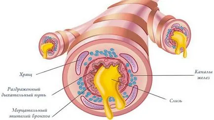 Infecția cu virusul respirator tractului Antibioticele superior (antibiotic) Antibiotice pentru infecții virale ale tractului respirator superior