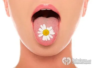 Sore sub limba - cauze, tratamentul, prevenirea