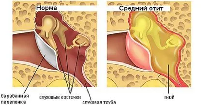 Earache ajutorul primului copil la domiciliu pentru a calma durerea