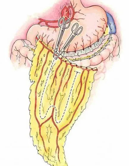 Caul anatomie, patologie, tratament