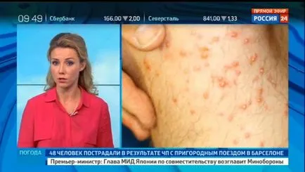 Ceea ce este diferit de ceata de Phobos meteovesti ceață