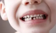 Ce se poate trece peste capul lui
