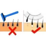 Care este aparatul și modul în care funcționează, diverse tehnici pentru a elimina coafor nedorite