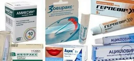 Herpes pe mâini și degete - cauze, simptome si tratament (foto)
