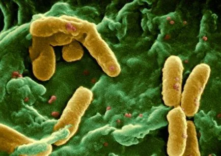 Bacteriile gram negative, structura și boala lor