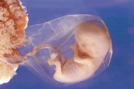 Embryo timp implantare și semne de implantare după FIV (semne) Embryo timp implantare si semne de implantare dupa FIV