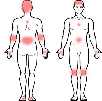 Cum începe simptome psoriazis sa recunoasca boala