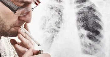 tuse fumator pentru a obține medicamente scapi, remedii populare (tuse) tuse fumator pentru a primi medicamente, remedii populare scapi