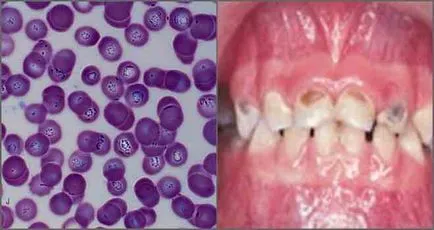 acarieni pericolele insidios, care se află în așteptare pentru tine (ca) acarieni pericolele insidios, care se află în așteptare pentru tine