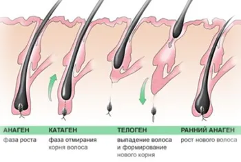 Pierderea parului Tratamentul de remedii populare (popular) Pierderea parului remedii populare Tratamentul