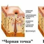 Cele mai multe metode naționale eficiente pentru tratarea unghiilor ciuperca