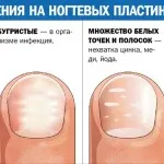 Cuticule ulei de utilizat și de ce este nevoie