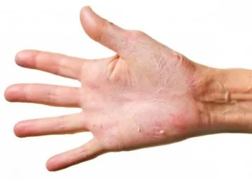 Unguent de fisuri pe mâinile unui efect de vindecare - o privire de ansamblu remedii populare creme și unguente uscăciune (crema pentru vindecarea fisurilor în mâini) Unguent de crăpături pe mâini cu un efect de vindecare - Revizuirea remedii populare creme și unguente din sec