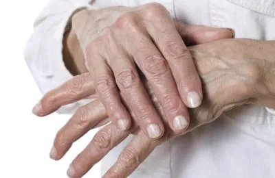 Unguent de fisuri pe mâinile unui efect de vindecare - o imagine de ansamblu remedii populare creme și unguente uscăciune (fisuri) Unguent de crăpături pe mâini cu un efect de vindecare - Revizuirea remedii populare creme și unguente din sec