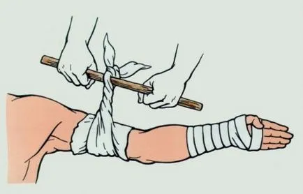 bandaj de compresie