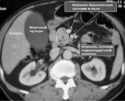 mri abdominale ce este, care verifică autoritățile