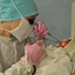 Chirurgie pentru a elimina polipi nazali video, fotografii si comentarii (polipi) Chirurgie pentru a elimina polipi nazali video, fotografii și recenzii