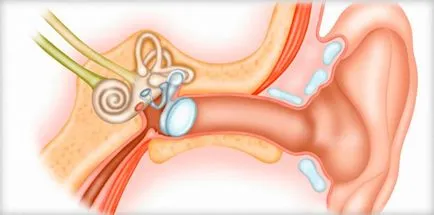 Senzație de apă în ureche ce să facă, cum să obțineți apă, picături speciale pentru cerumen rasstvoreniya