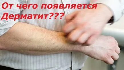 De atunci dermatita apare