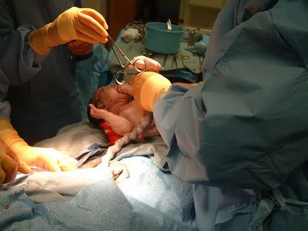 În cazul în care copiii se târască la naștere fotografie, naștere pentru copii