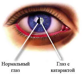 motive vederii Falls, vârstă, stă brusc pe un computer, un adolescent, după 40 de ani (cauza) motive vederii Falls, vârstă, stă brusc pe un computer, un adolescent, după 40 de ani