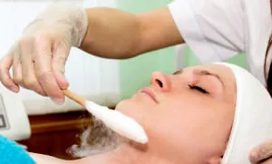 Face peeling - este un produs chimic, cu ultrasunete și altele înainte și după fotografii, cum se face în (față) Face peeling - este un produs chimic, cu ultrasunete și altele înainte și după fotografii, cum se face în