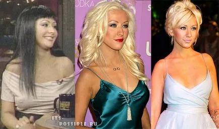 Chirurgia plastica Christina Aguilera