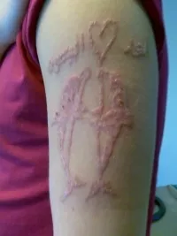 Consecințele tatuare