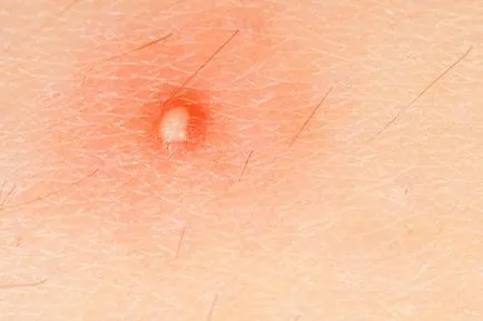Cosurile pe mâini, degete