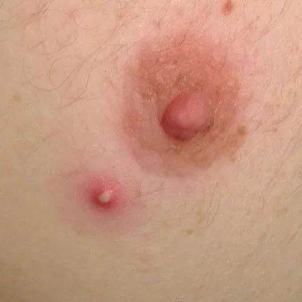 Cosurile de pe piept