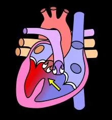 Sistemul structurii inimii, funcția și caracteristici anatomice și fiziologice Efectuarea