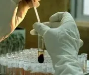 Riscul de infectare cu HIV a personalului medical (risc) Riscul de infectare cu HIV a personalului medical