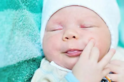 Nevilor au fotografii de nou-nascuti, tipuri de cauze pete de vârstă